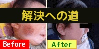 肌トラブル解決方法